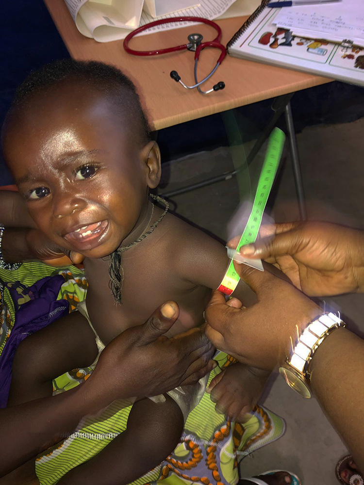 Ready to use Therapeutic Food